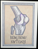 Being Bionic Isn't Easy - Knee Replacement Card