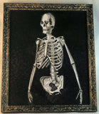 Skeleton Torso and skull framed print